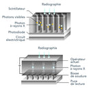 Capteur intra-oral X-ray sensor - XPECT VISION - Safe Implant