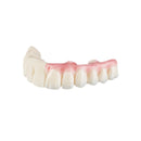 Résine 3D longue durée pour bridges implantaires provisoires - TEMP ULTRA - ArmaResin - Safe Implant