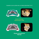Système d’imagerie panoramique 3D / 2D - Smart 2 - Vatech - Safe Implant