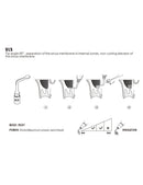 Insert UL5 pour chirurgie piezo - WOODPECKER - Safe Implant