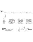 Insert US1 pour chirurgie piezo - WOODPECKER - Safe Implant